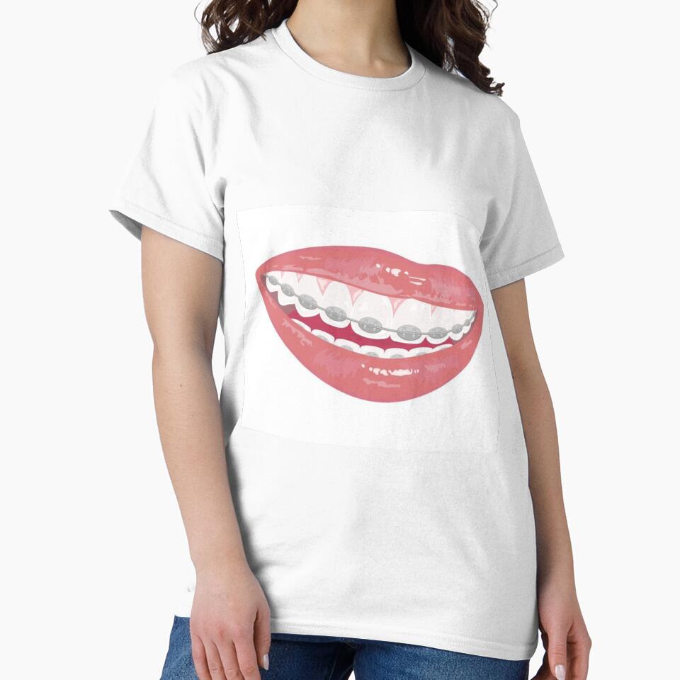 Braces by Sipsta